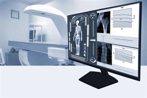 dexa scan singapore|DEXA Scan Singapore, Same Day Appointment.
